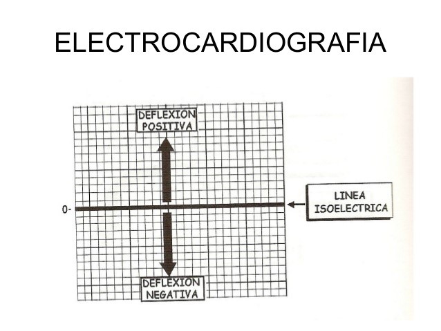 Electrocardiografia